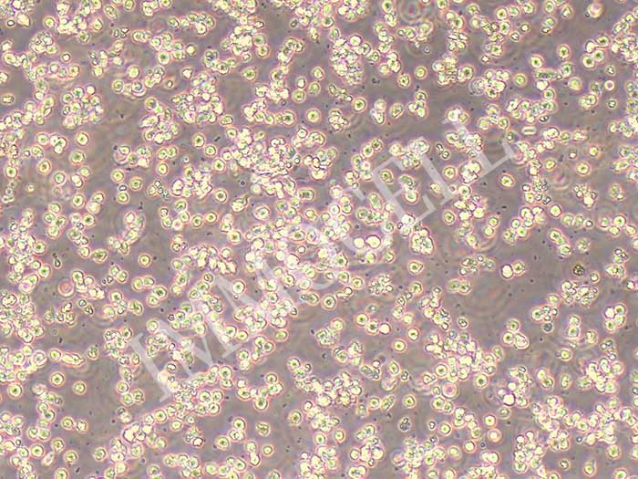 OCI-LY10细胞细胞图片
