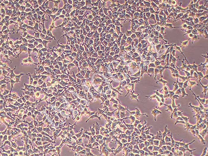293T人胚肾细胞图片