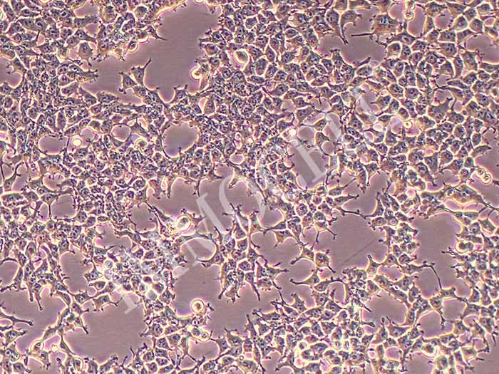293T人胚肾细胞图片