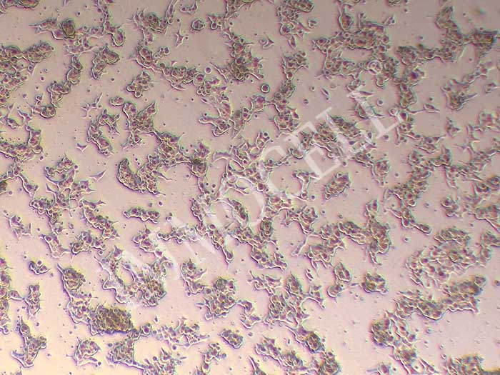 LAPC4人前列腺癌细胞图片