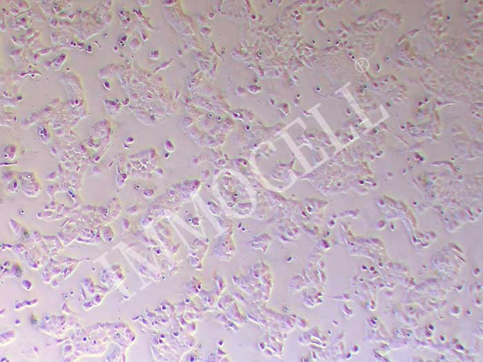 OV-90人卵巢癌细胞图片