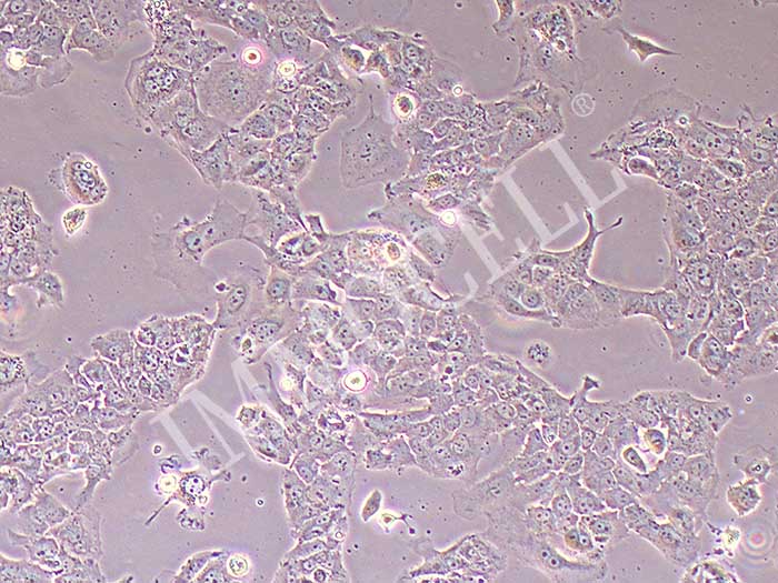 OV-90人卵巢癌细胞图片