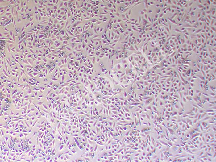 PSN1人胰腺癌细胞图片