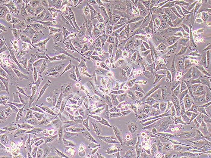 PSN1人胰腺癌细胞图片