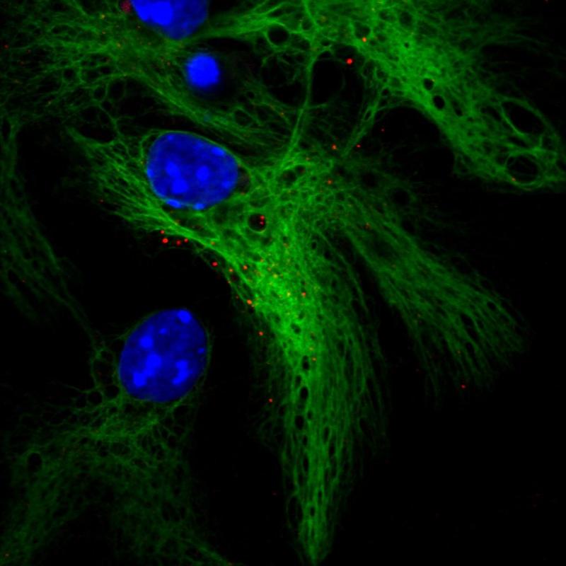 神经干细胞分化为星形胶质细胞（绿色），生长激素受体位点显示为红色(1).jpg