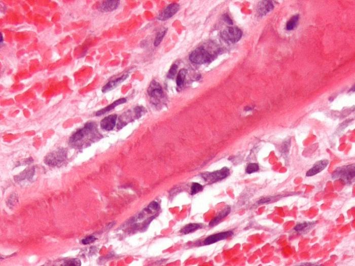 成骨细胞（Osteoblast）