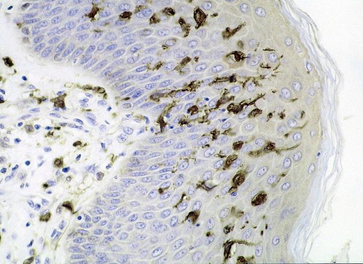 树突状细胞(Dendritic cells)
