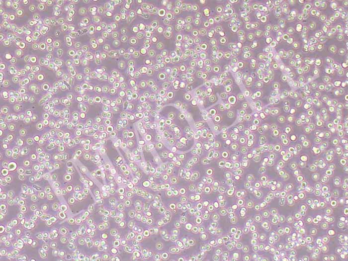 CEM/C1细胞细胞图片