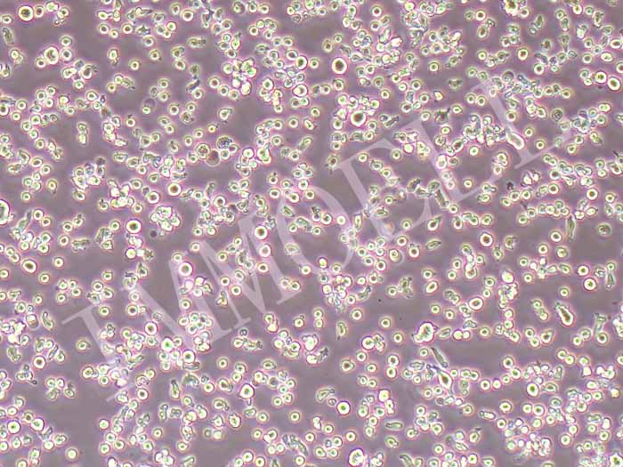 MM.1R人多发性骨髓瘤细胞图片