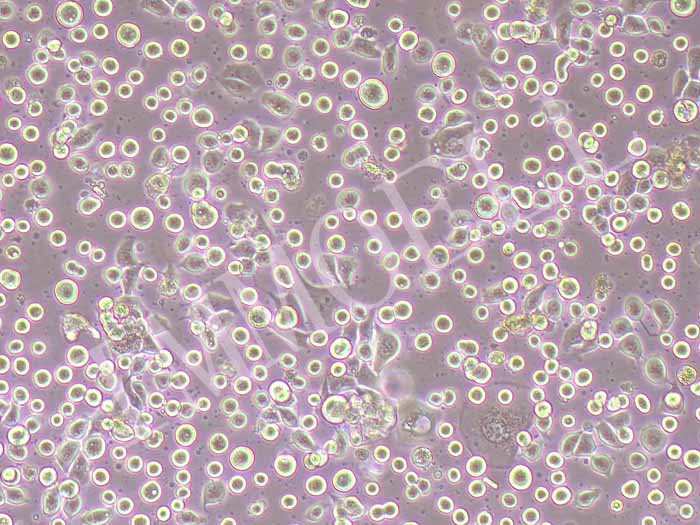 NCI-H1869细胞细胞图片