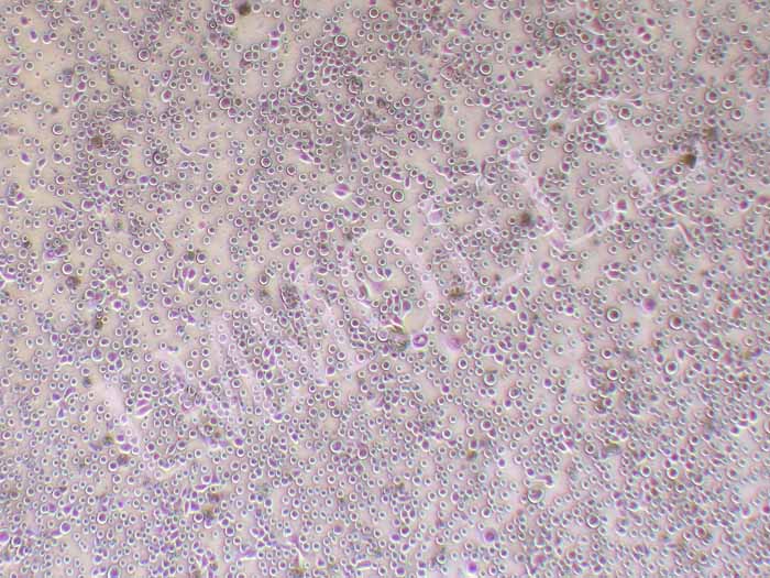 NCI-h1869人非小细胞肺癌鳞癌细胞图片