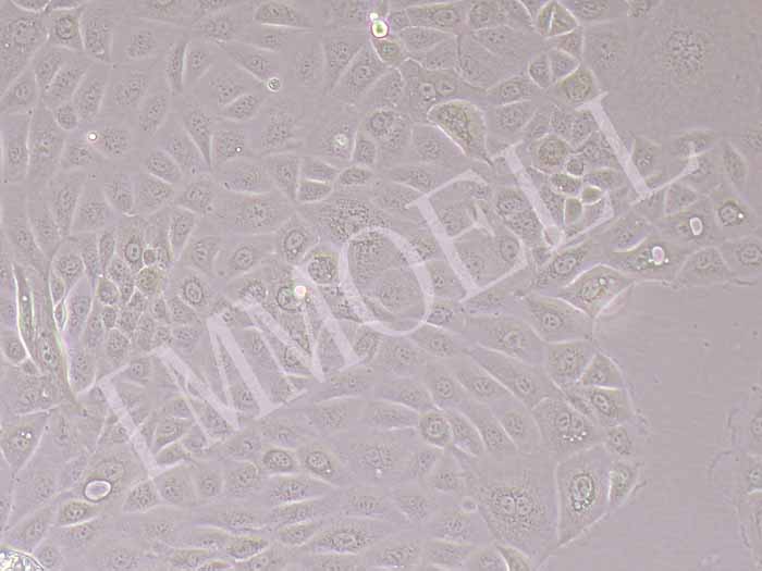 PANC 05.04人胰腺癌细胞图片