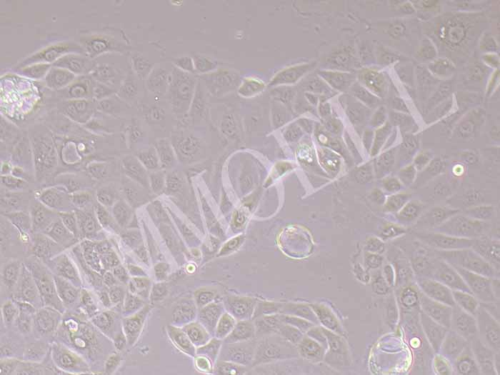 PANC 05.04人胰腺癌细胞图片