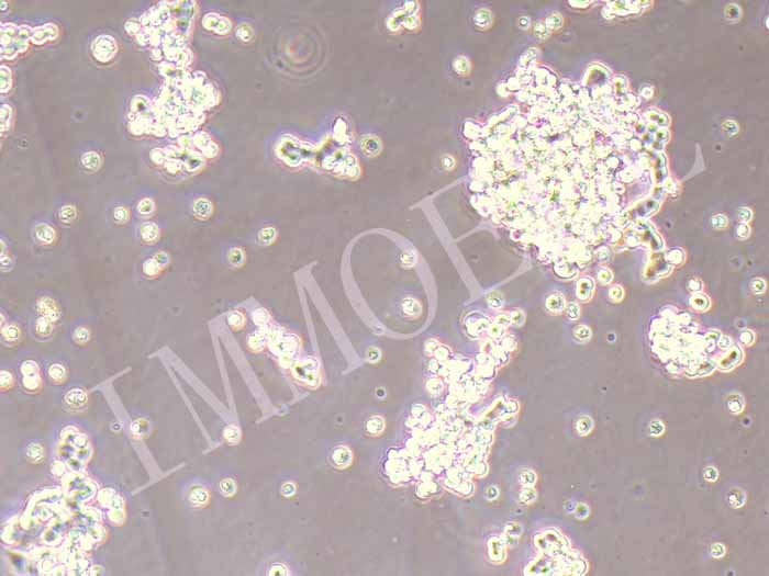 SHP-77人小细胞肺癌细胞