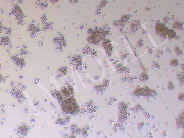 SHP-77人小细胞肺癌细胞图片