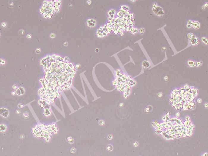 SHP-77人小细胞肺癌细胞图片