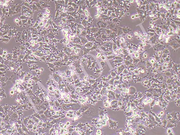 A-427人肺癌细胞图片