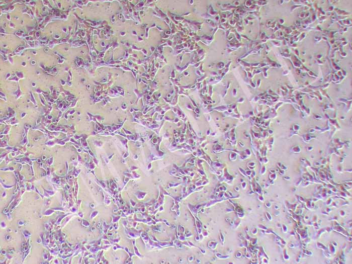 HCC70人乳腺导管癌细胞图片