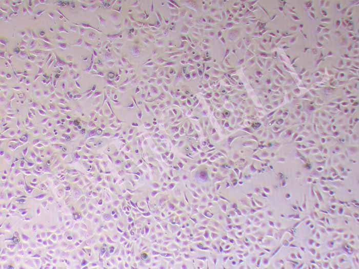 KLN205小鼠肺癌鳞癌细胞图片