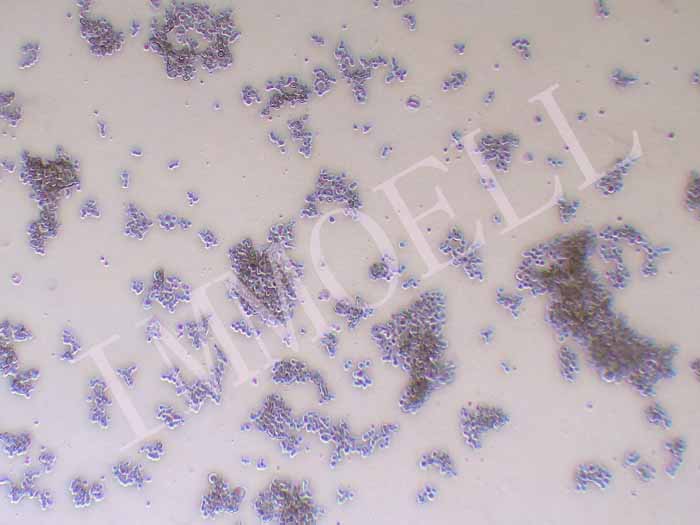 NCI-H146人小细胞肺癌细胞图片