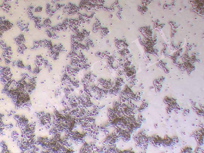 NCI-H526人小细胞肺癌细胞图片