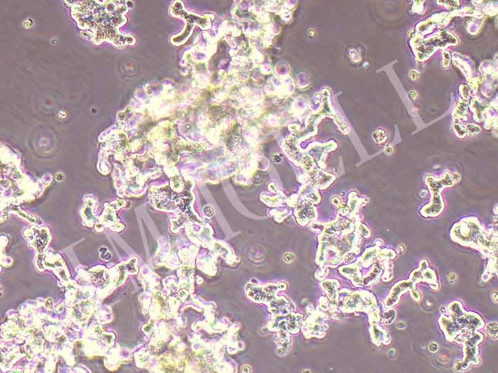 NCI-H526人小细胞肺癌细胞图片