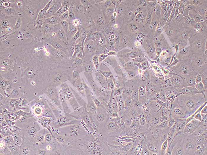 NCI-H2347人非小细胞肺癌细胞图片