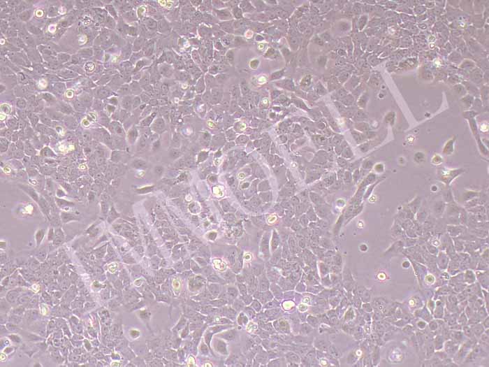 UPCI:SCC154人舌鳞癌细胞