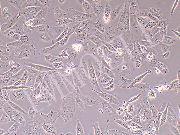 SK-LU-1人低分化肺腺癌细胞