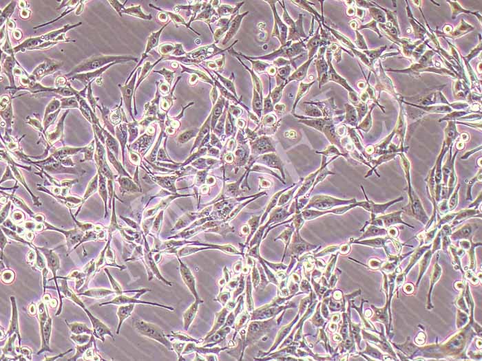 LA795小鼠肺腺癌细胞细胞图片