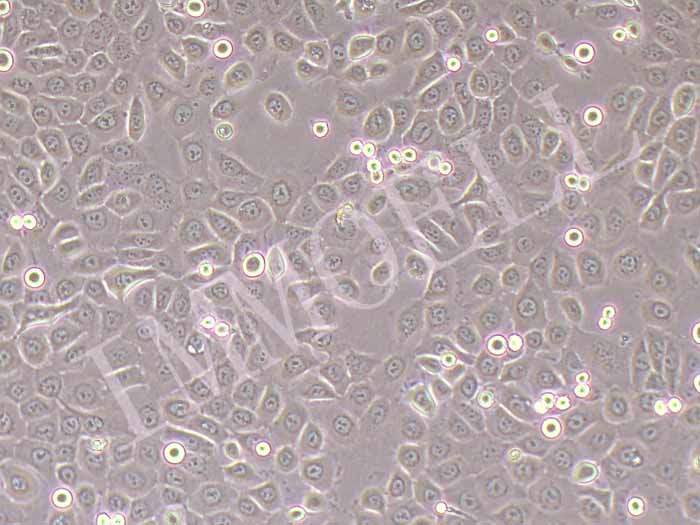 BPH-1人前列腺增生细胞图片