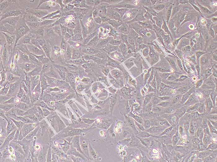 NCI-H596人肺腺鳞癌细胞图片