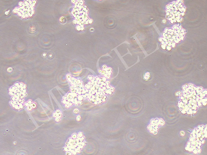 NCI-H660-Nluc-puro（人神经内分泌前列腺癌细胞-Nluc荧光素酶标记-抗puro）