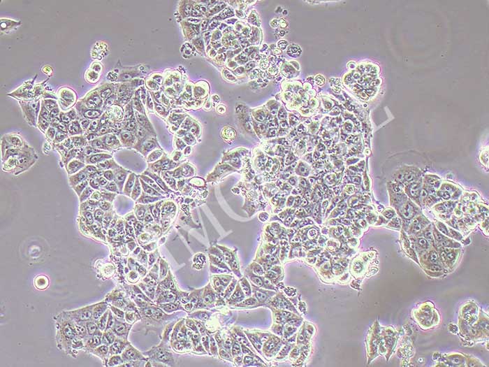 MCF-7-GFP-puro人乳腺癌细胞(GFP标记)