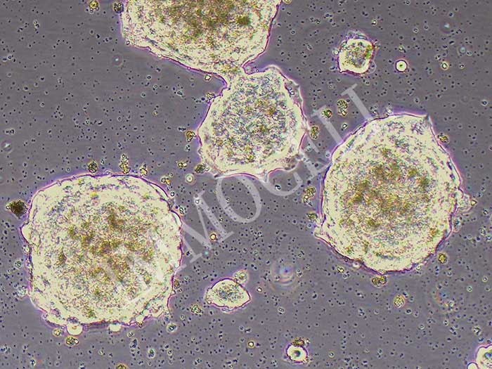 NCI-H1688人经典小细胞肺癌细胞