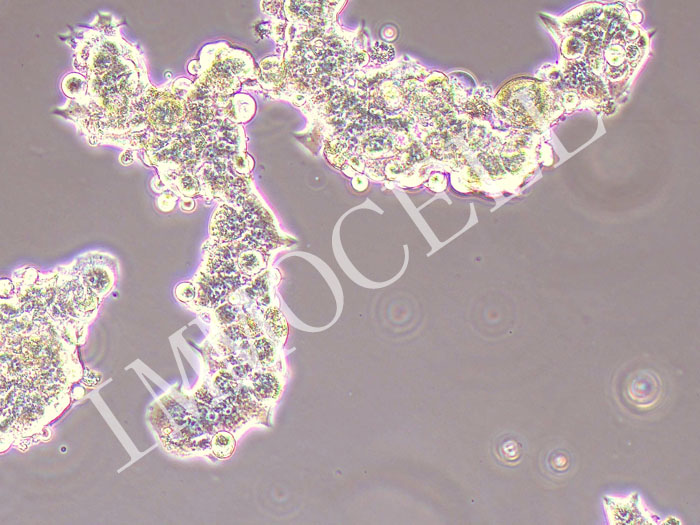 LAPC-4-FLUC-puro人前列腺癌细胞 (FLUC标记)