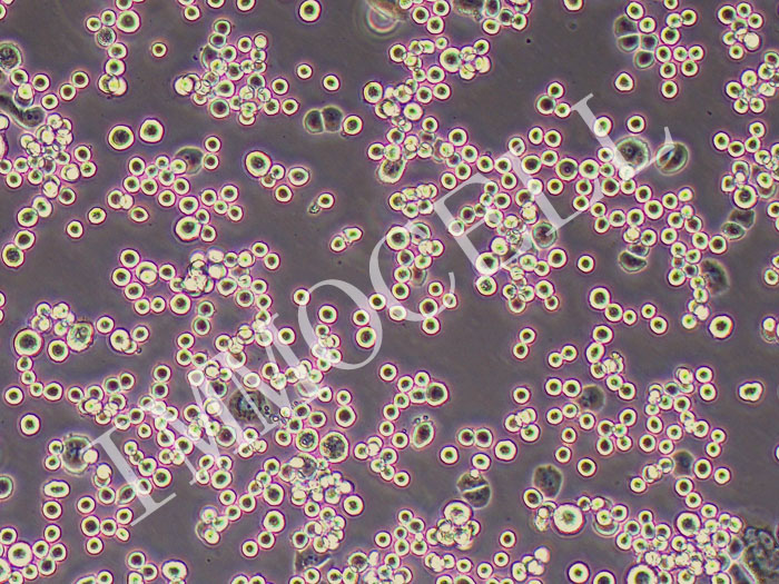 MDA-MB-453人乳腺癌细胞（STR鉴定正确）