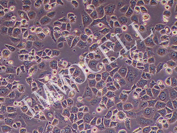 CC-LP-1人肝内胆管癌细胞