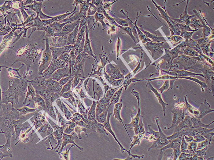 HCC2279人肺癌细胞（混合）（STR鉴定）