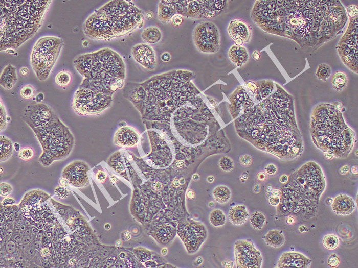 SW1116人结肠腺癌细胞（STR鉴定正确）