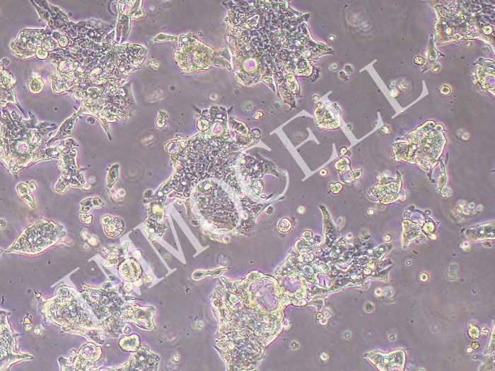 CL-40人结肠癌细胞(STR鉴定正确)