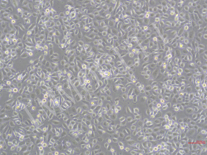 5637-FLUC-puro人膀胱癌细胞 (FLUC标记)