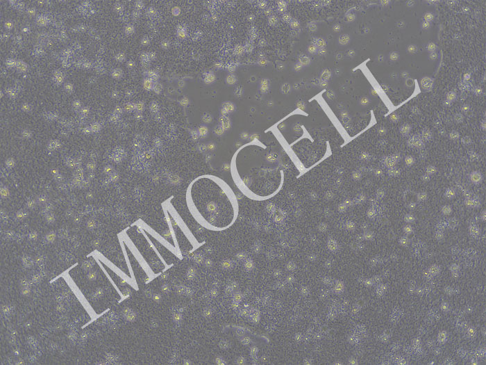 hiPSC-CAS9细胞株