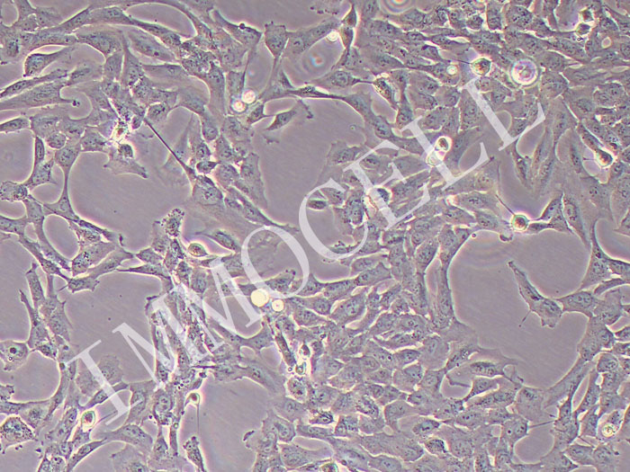 人心肌成纤维细胞永生化