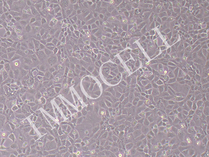 大鼠淋巴内皮细胞永生化