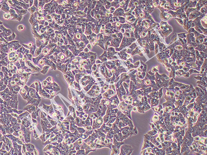 LS180人结肠腺癌细胞(STR鉴定正确)