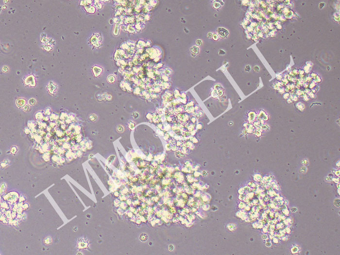 HH人皮肤T淋巴细胞瘤细胞（STR鉴定正确）