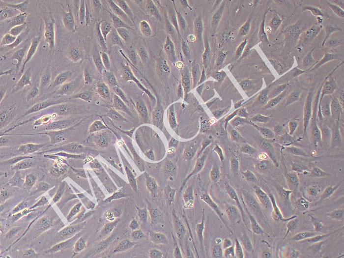 人肺动脉内皮细胞（永生化）