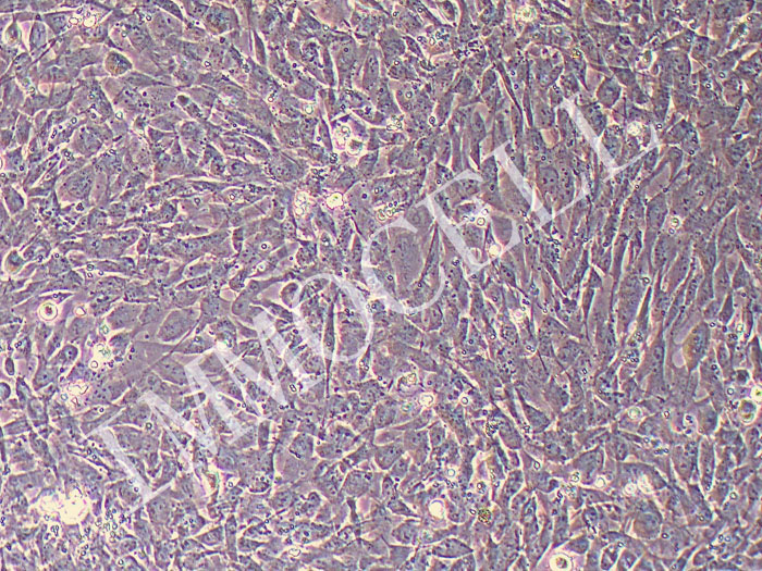 人骨髓间充质干细胞永生化（物种鉴定正确）