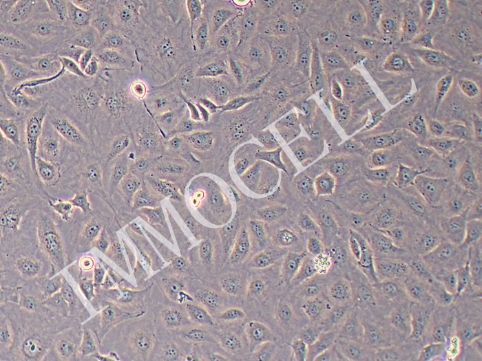 ECV-304人脐静脉内皮细胞/人膀胱癌细胞（STR鉴定正确）